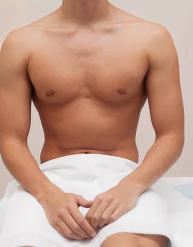 depilación láser diodo cuerpo entero hombre Barcelona Dream Body Sants